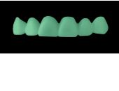 Cod.C6Facing : 10x  wax facings-bridges,  MEDIUM, Square ovoid, TOOTH 13-23, compatible with Cod.A6Lingual,TOOTH 13-23 for long-term provisionals preparation